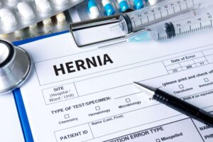 Hernia mesh recalled for flaws & injuries