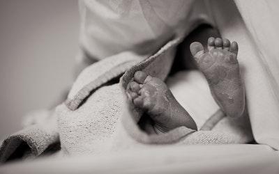 Wrongful Birth: The Antithesis of Wrongful Death