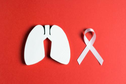 Can asbestos lung cancer be cured?