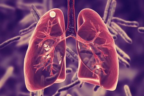 What is a lesion on the lung