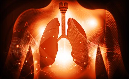 What type of lung cancer is caused by asbestos?