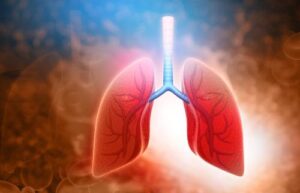 What Lung Cancer Is Caused By Asbestos