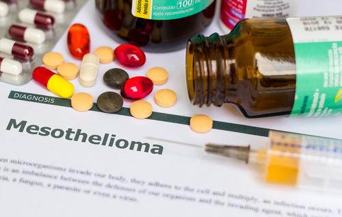 Can a Chest X-Ray Show Mesothelioma?