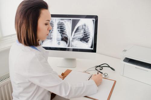 Can a chest x-ray show asbestos?