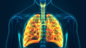 Can a Lung Transplant Cure Lung Cancer?