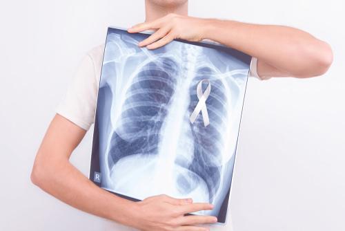 Does mesothelioma affect both lungs