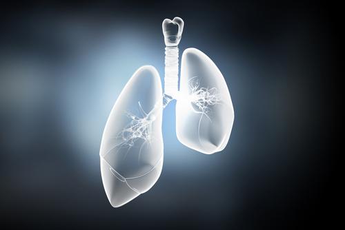 How do you know if lung cancer is caused by asbestos?