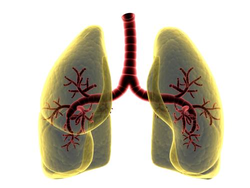 How long can lung cancer go untreated?