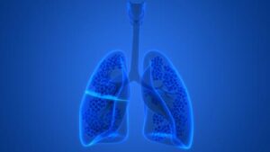 Is mesothelioma a type of lung cancer