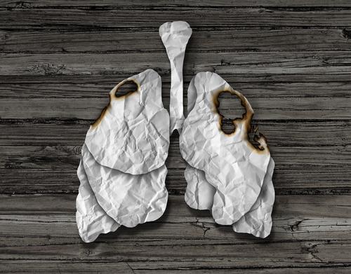 Is non small cell lung cancer the same as mesothelioma?