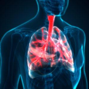 Why Is Stage 4 Lung Cancer Inoperable?