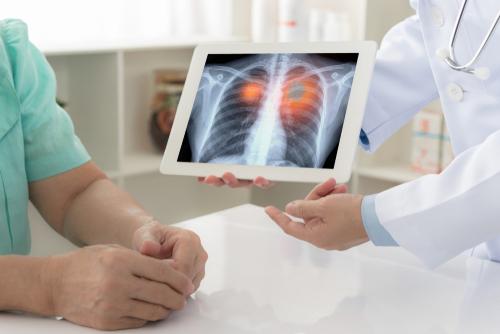 Can lung cancer go into remission?