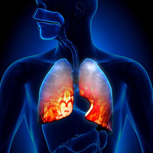 Do you always lose weight with lung cancer?