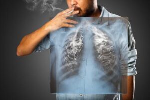 How Do You Get Lung Cancer without Smoking?