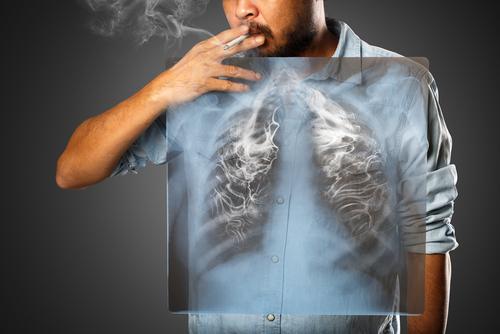 How do you get lung cancer without smoking