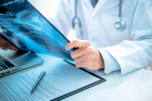 Is Lung Cancer Always Terminal