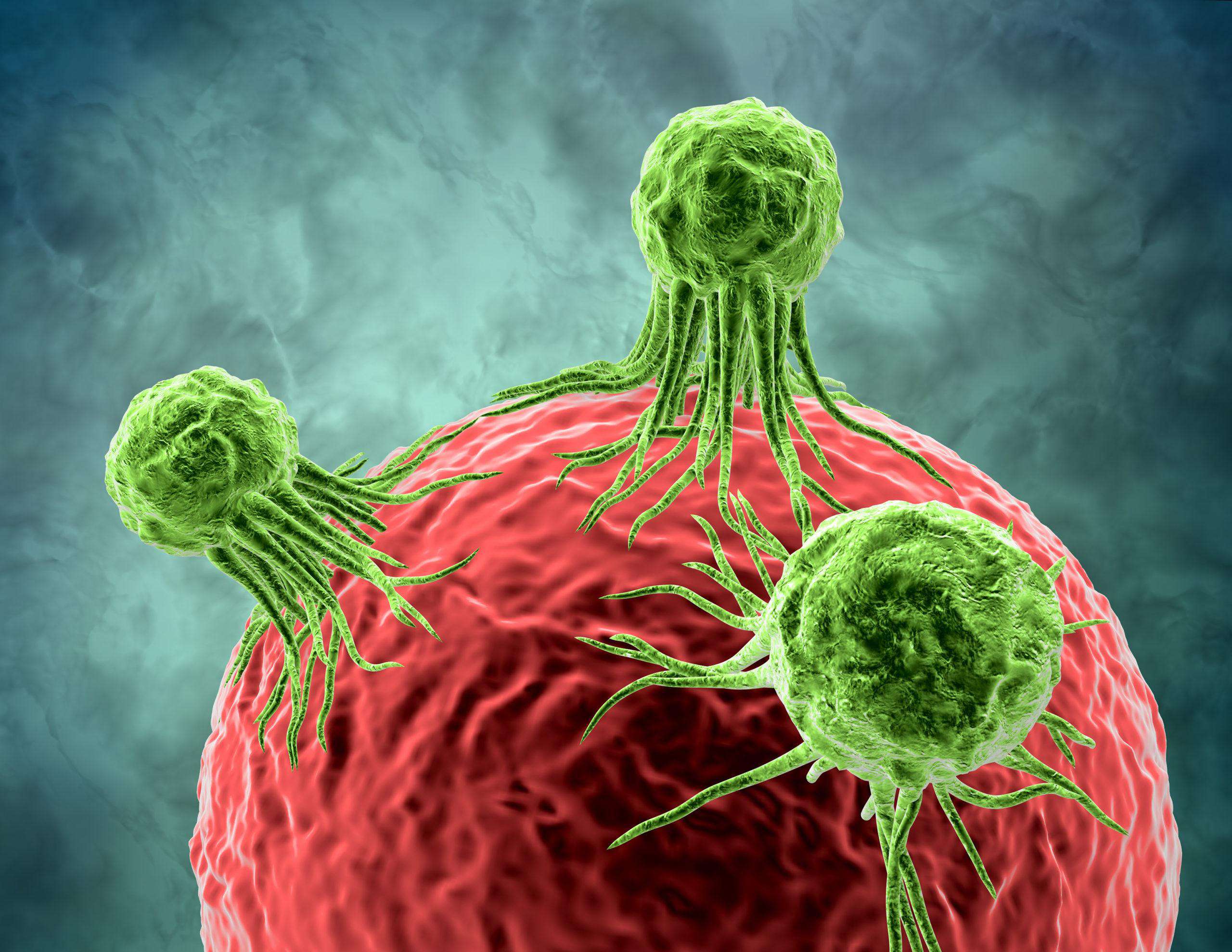 Is Mesothelioma a Slow Growing Cancer