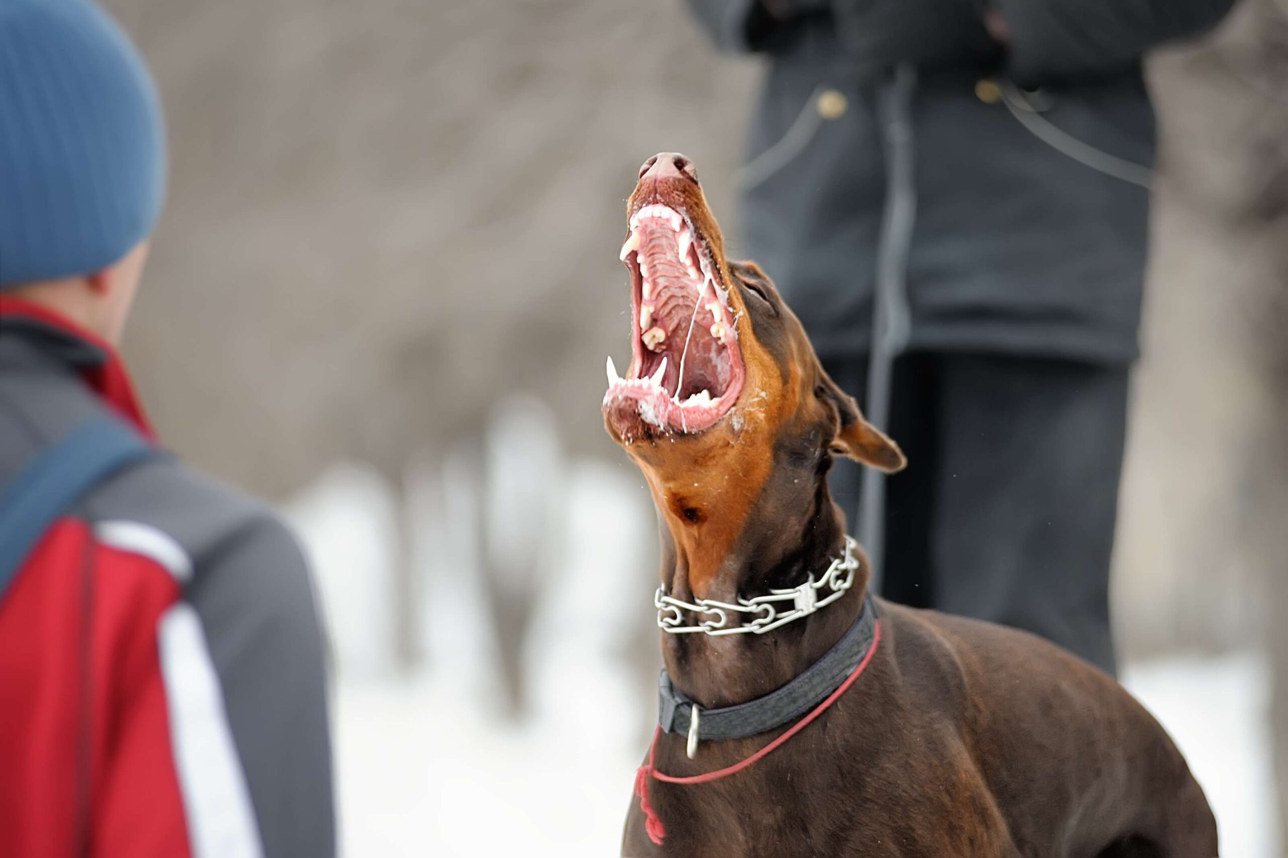 Los Angeles Coldwater Canyon Park Dog Bite Lawyer