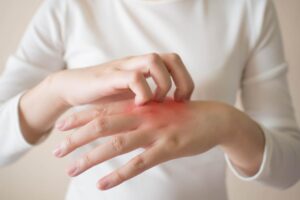 How do you get roundup off your skin?