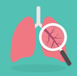 How Do You Know If You Have Asbestos in Your Body?