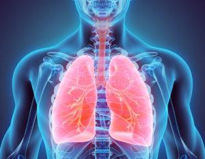 Can Peritoneal Mesothelioma Spread to the Lungs?