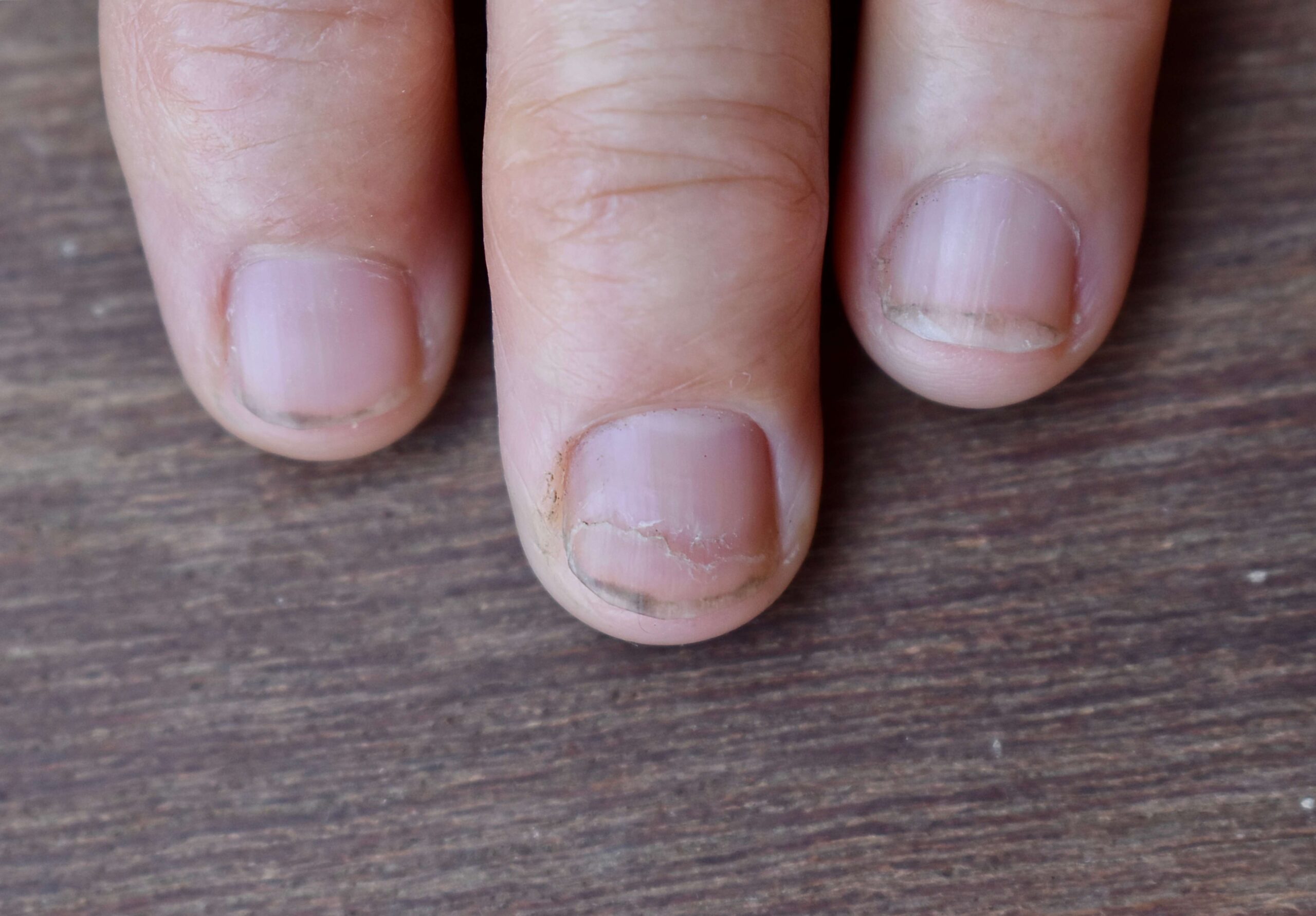 soiled clothes or other signs of poor hygiene