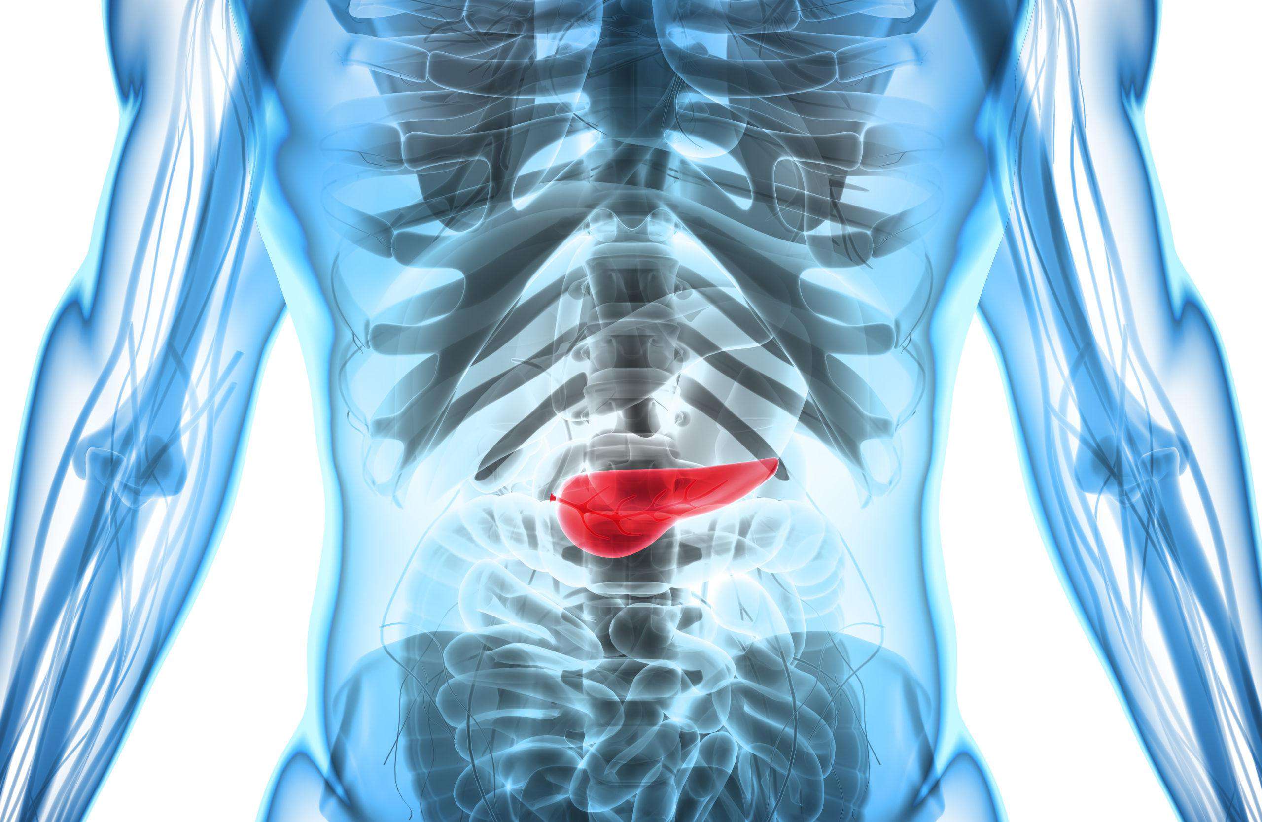 does roundup cause pancreatic cancer