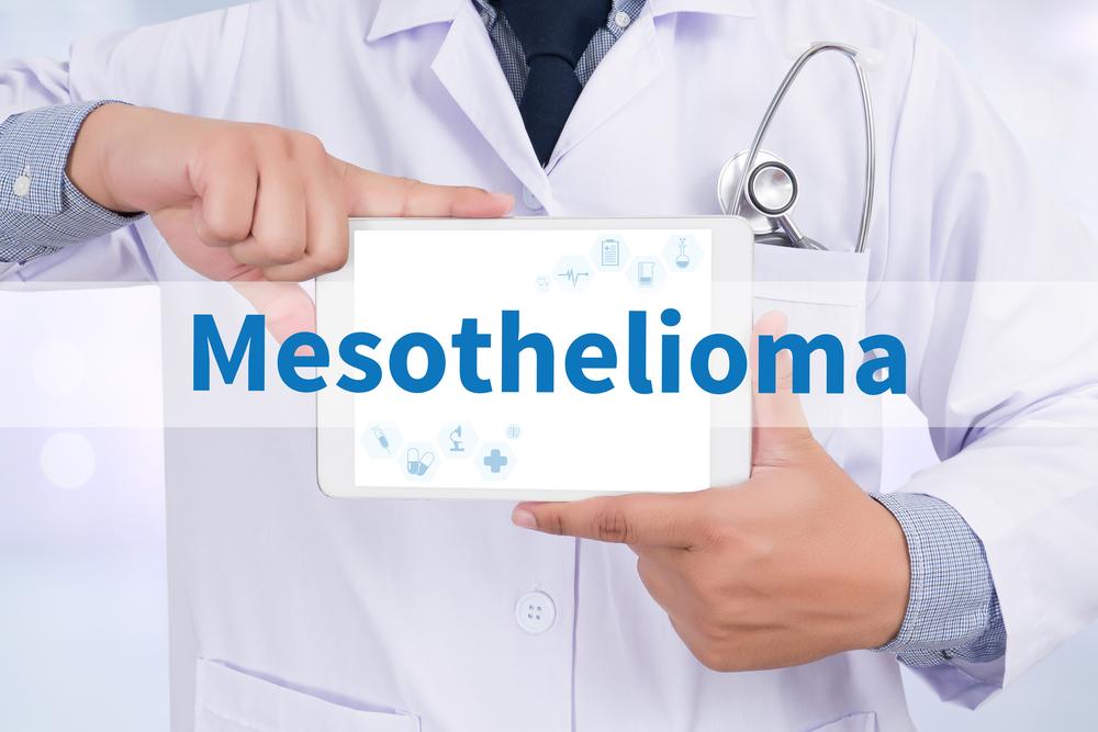 Michigan Mesothelioma Lawyer