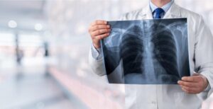 Can you have lung cancer and not know it?
