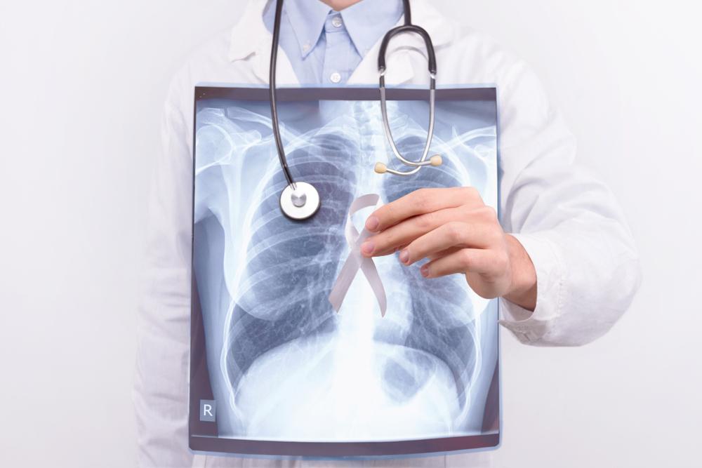 signs of malignant mesothelioma