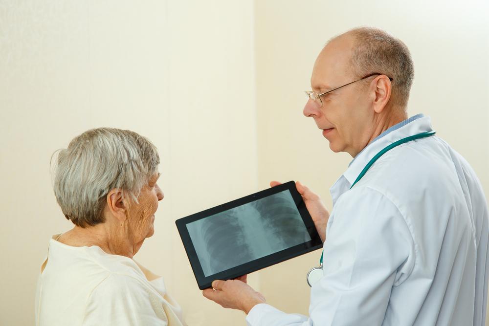 Lung Cancer