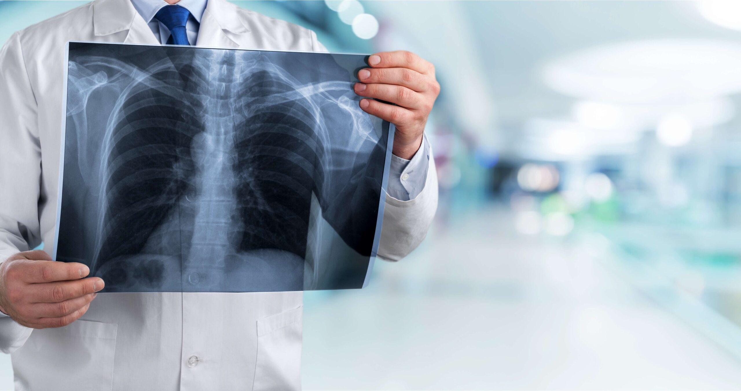 Lung Cancer