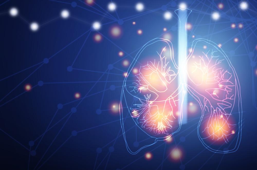 What are the odds of beating lung cancer?